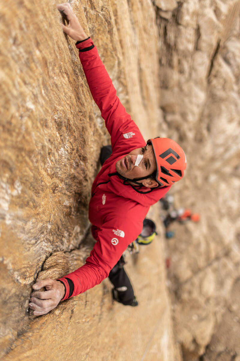 Alex Honnold wears tape on his nose having been hit by falling ice as he ascends Pool Wall in E ...
