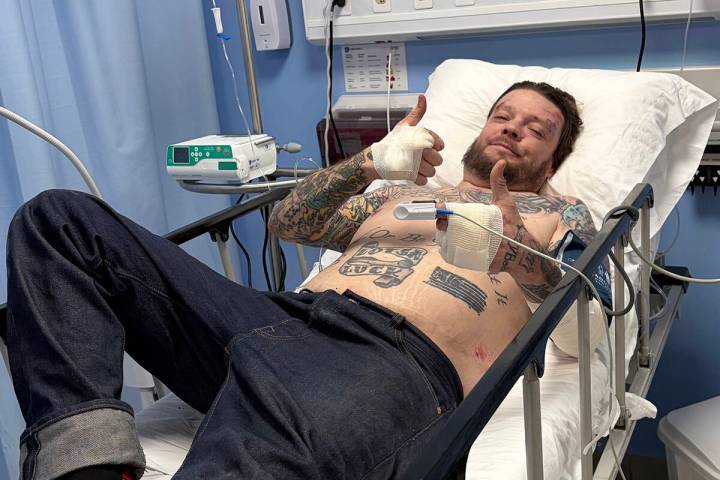 Corey Harrison is shown in a hospital room in Tulum, Mexico, after an accident on his Harley-Da ...